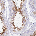 Immunohistochemical staining of human testis shows strong cytoplasmic positivity in spermatids.