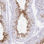 Immunohistochemical staining of human testis shows strong cytoplasmic positivity in spermatids.