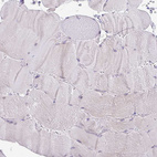 Immunohistochemical staining of human skeletal muscle shows no positivity in myocytes as expected.