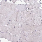 Immunohistochemical staining of human skeletal muscle shows no positivity in myocytes as expected.