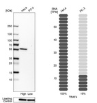 Western blot analysis in human cell lines HeLa and PC-3 using Anti-TRAF4 antibody. Corresponding TRAF4 RNA-seq data are presented for the same cell lines. Loading control: Anti-HSP90B1.