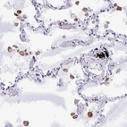 Immunohistochemical staining of human lung shows strong cytoplasmic positivity in macrophages.