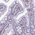 Immunohistochemical staining of human small intestine shows strong cytoplasmic positivity in lymphoid cells.