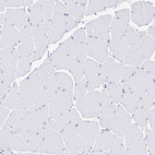 Immunohistochemical staining of human skeletal muscle shows no positivity in myocytes as expected.