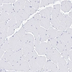 Immunohistochemical staining of human skeletal muscle shows no positivity in myocytes as expected.