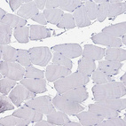 Immunohistochemical staining of human skeletal muscle shows no positivity in myocytes as expected.