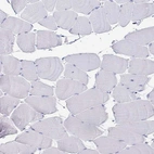 Immunohistochemical staining of human skeletal muscle shows no positivity in myocytes as expected.