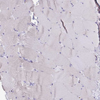 Immunohistochemical staining of human skeletal muscle shows no positivity in myocytes as expected.