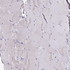 Anti-LCN15 Antibody