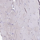 Immunohistochemical staining of human skeletal muscle shows no positivity in myocytes as expected.