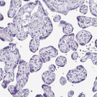 Immunohistochemical staining of human placenta shows no positivity in trophoblastic cells as expected.