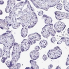 Immunohistochemical staining of human placenta shows no positivity in trophoblastic cells as expected.
