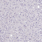 Immunohistochemical staining of human liver shows no positivity in hepatocytes as expected.