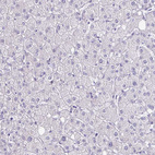 Anti-LCN15 Antibody