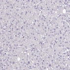 Immunohistochemical staining of human liver shows no positivity in hepatocytes as expected.