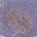 Immunohistochemical staining of human tonsil shows strong membranous positivity in germinal center cells.