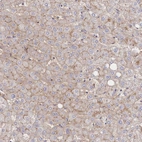 Immunohistochemical staining of human liver shows strong membranous positivity in hepatocytes.
