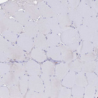 Immunohistochemical staining of human skeletal muscle shows no positivity in myocytes as expected.