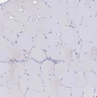 Immunohistochemical staining of human skeletal muscle shows no positivity in myocytes as expected.