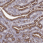 Immunohistochemical staining of human small intestine shows strong cytoplasmic positivity in glandular cells.