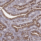 Immunohistochemical staining of human small intestine shows strong cytoplasmic positivity in glandular cells.