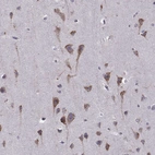 Immunohistochemical staining of human cerebral cortex shows strong cytoplasmic positivity in neurons.