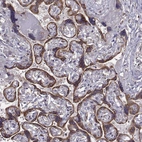 Immunohistochemical staining of human placenta shows strong cytoplasmic positivity in trophoblastic cells.