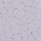 Immunohistochemical staining of human skeletal muscle shows no positivity in myocytes as expected.