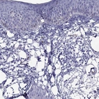 Immunohistochemical staining of human skin shows no positivity in squamous epithelial cells as expected.