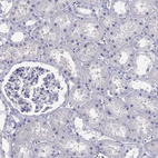 Anti-PIH1D3 Antibody