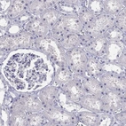 Immunohistochemical staining of human kidney shows no positivity in cells in tubules as expected.