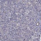Immunohistochemical staining of human pancreas shows strong membranous positivity in ductal cells.