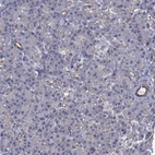 Immunohistochemical staining of human pancreas shows strong membranous positivity in ductal cells.