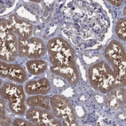 Immunohistochemical staining of human kidney shows strong cytoplasmic positivity in cells in tubules.