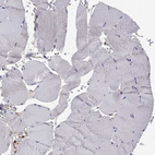 Immunohistochemical staining of human skeletal muscle shows no positivity in myocytes as expected.