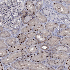 Immunohistochemical staining of human kidney shows strong nuclear positivity in cells in tubules.