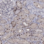 Immunohistochemical staining of human kidney shows strong nuclear positivity in cells in tubules.