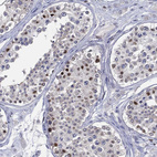Immunohistochemical staining of human testis shows strong nuclear positivity in cells in seminiferous ducts.