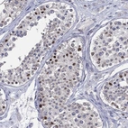 Immunohistochemical staining of human testis shows strong nuclear positivity in cells in seminiferous ducts.