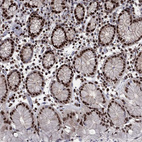 Immunohistochemical staining of human stomach shows strong nuclear positivity in glandular cells.
