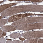 Immunohistochemical staining of human skeletal muscle shows strong cytoplasmic positivity in myocytes.
