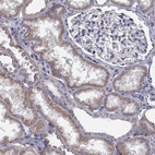 Immunohistochemical staining of human kidney shows moderate cytoplasmic positivity in cells in tubules.