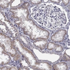 Immunohistochemical staining of human kidney shows moderate cytoplasmic positivity in cells in tubules.