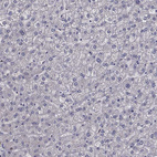 Anti-HSPB2 Antibody