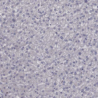 Immunohistochemical staining of human liver shows no positivity in hepatocytes as expected.
