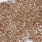 Anti-OSGEPL1 Antibody