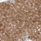 Immunohistochemical staining of human liver shows strong cytoplasmic positivity in hepatocytes.
