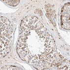 Immunohistochemical staining of human testis shows strong cytoplasmic positivity in cells in seminiferous ducts.