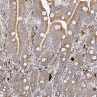 Immunohistochemical staining of human duodenum shows strong cytoplasmic positivity in glandular cells.