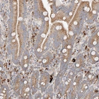 Immunohistochemical staining of human duodenum shows strong cytoplasmic positivity in glandular cells.